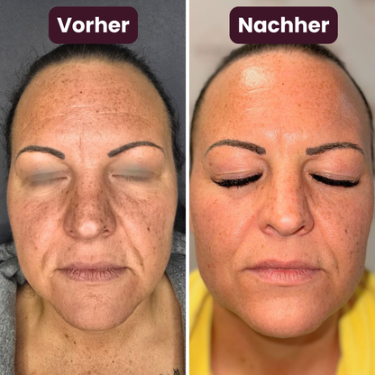 Seloro Glatte Haut Duo