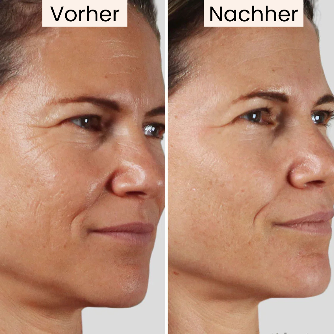 VitaGlow – für eine straffere Haut